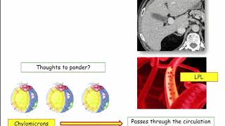 12DaysinMarch, Podcast Series, Chylomicron Formation and Fat Absorption for the USMLE Step One Exam