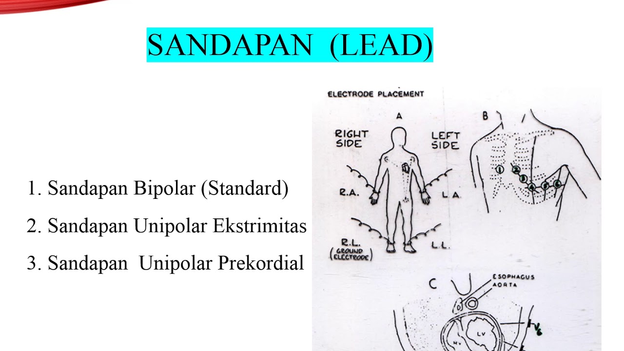 EKG BAGIAN 1
