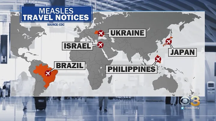 Consider Measles Outbreak When Planning Summer Travel, Health Officials Warn