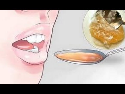 remedios naturales para la artritis Traga esto, quedarás dormido casi al instante, permanecerás dormido y despertarás renovado!