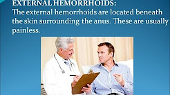 how do get rid of hemorrhoids , how to get rid of hemorrhoids yahoo