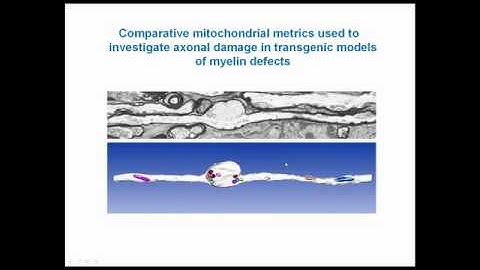 Serial block face scanning EM webinar