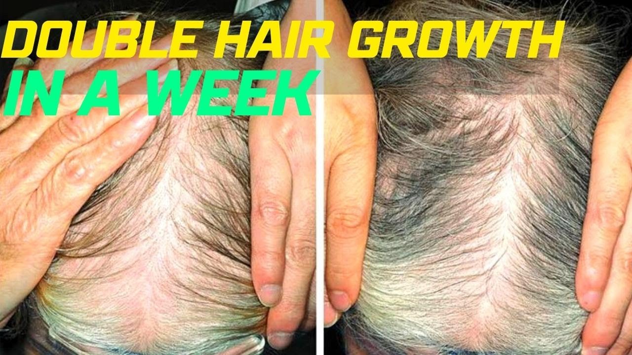 thick hair long layers I Went from Thin to Thick Hair in Just a Week