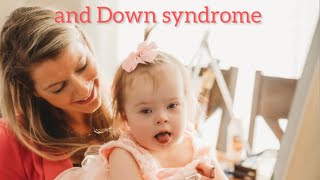 Life with a baby who has half a heart and Down syndrome