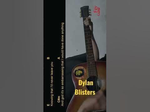 Dylan - Blisters Guitar Chords cover #shorts 