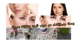 وصفة لتخلص من حبوب الوجه وإعطائه  أكثر نضارة وتخلص من بقعه جربي ولا تندمي?