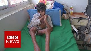 Yemen's 'forgotten conflict' - BBC News