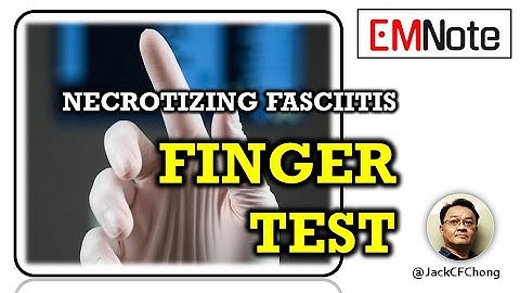 Finger Test for Necrotizing Fasciitis