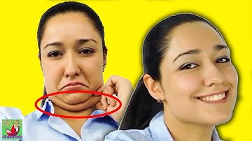 HÔ BIẾN MẶT 2 CẰM TRỞ THÀNH V-LINE THON GỌN MÀ KHÔNG CẦN PHẪU THUẬT THẨM MỸ