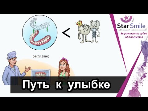 Элайнеры. Уверенный шаг к красоте улыбки без брекетов. Как работает система.