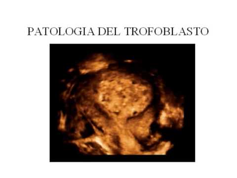 Patologia del trofoblasto