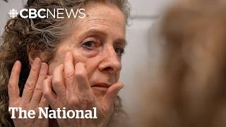Dermatology wait times skyrocket in Canada — unless you want Botox