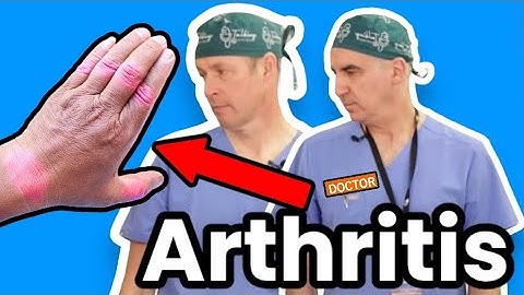 Best Way To Stop Arthritis - Or At Least Slow It Down