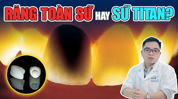 Răng Sứ Titan và Toàn Sứ: Bác Sĩ Nói Thẳng SỰ THẬT Nhiều Nha Khoa Không Dám Kể