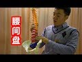 医学实例详解：腰椎间盘突出的保守治疗第1招，自我缓解腰腿痛