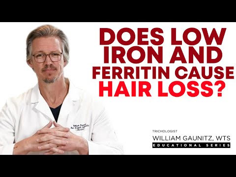 Anemia Hair Loss: Iron Deficiency, Low Ferritin, and Hair Thinning