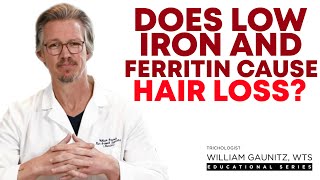 Anemia Hair Loss: Iron Deficiency, Low Ferritin, and Hair Thinning