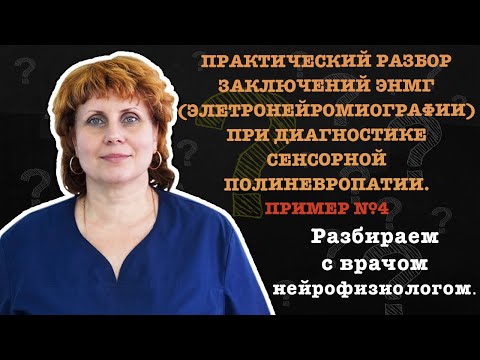 ПРИМЕР №4 ПРАКТИЧЕСКИЙ РАЗБОР ЗАКЛЮЧЕНИЯ ЭНМГ ПРИ ДИАГНОСТИКЕ СЕНСОРНОЙ ПОЛИНЕВРОПАТИИ