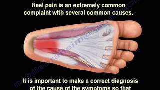 Heel Pain and plantar fascitis , Everything You Need To Know - Dr. Nabil Ebraheim