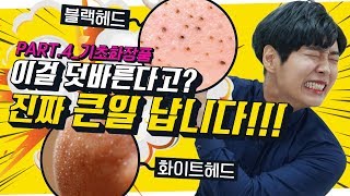 🔍 블랙헤드, 화이트헤드의 원인? │ 완전 간단