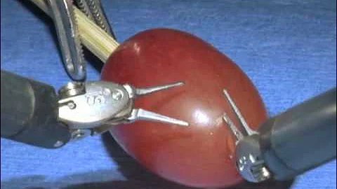 da Vinci Surgical System: Surgery on a grape - DayDayNews