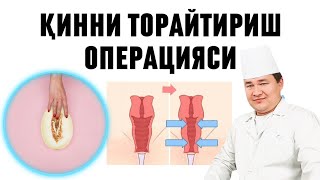 ҚИННИ ТОРАЙТИРИШ ОПЕРАЦИЯСИ САЛБИЙ ВА ИЖОБИЙ ТОМОНЛАРИ / ВАГИНОПЛАСТИКА  ЖАРАЁНИ ҚАНДАЙ ҚИЛИНИШИ