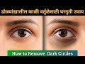       dark circles around eyes by dr rupesh amale