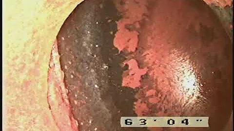 181 Madison ave Berlin NH sewer inspection