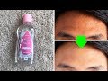 Get Rid of Dark Spots Using Baby Oil