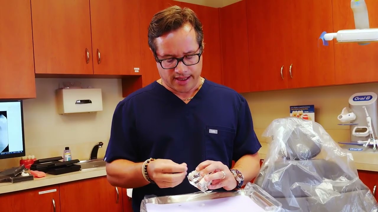 Dental Implants alternatives