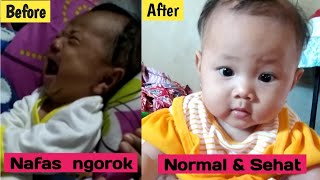 Download Nafas Bayi Grok-grok Part 2 - Alivia Sudah Sehat Dan Normal Video MP3 Nafas Bayi Grok-grok Part 2 - Alivia Sudah Sehat Dan Normal