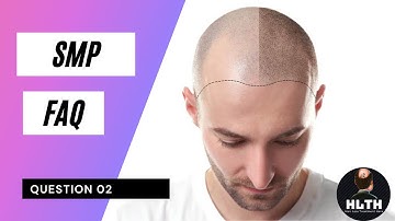 Is Scalp MicroPigmentation SMP Worth It | Direct Answering (Clear Explanation) 2021 - FAQ 02