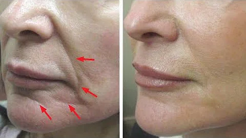 Just 2 skin tightening and face lifting home remedies - DayDayNews