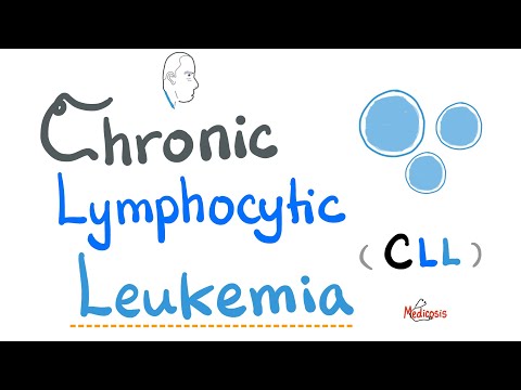 Video: Monoallelinės Ir Biallelinės 13q14 Delecijos CLL / SLL Pacientų Grupėje, Tiriamoje CGH Hematologinio Vėžio Ir SNP Masyvo (8x60K)