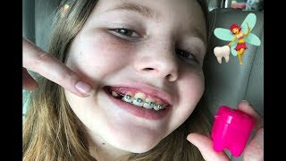 BRACES✨Dentist Pulls Tooth