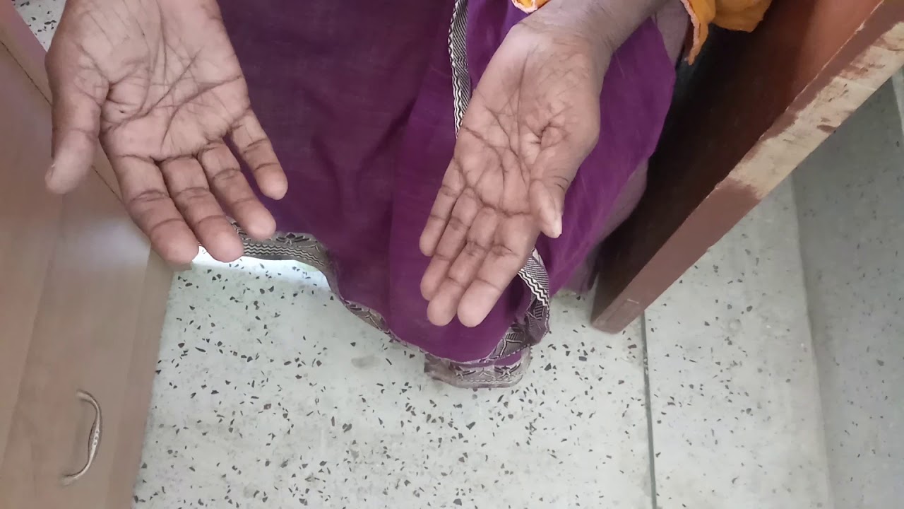 Clinical Scenario: Idiopathic Parkinson Disease - YouTube