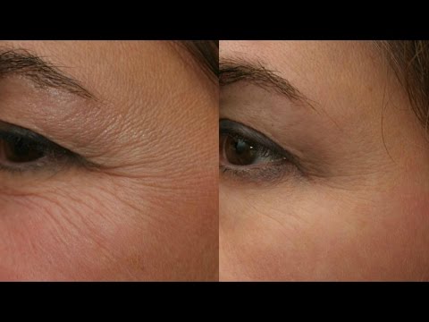 reduce-wrinkles-naturally-|-ayurvedic-home-remedy