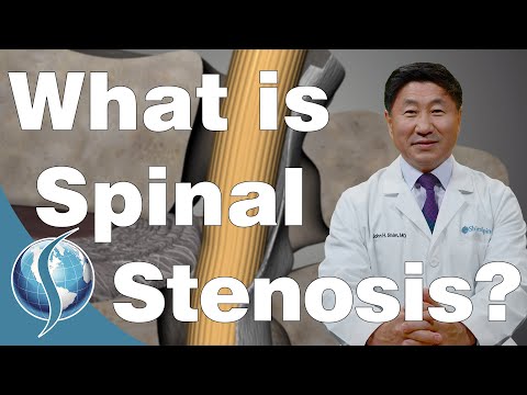 Effective Lumbar Stenosis Exercises. 