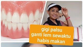 Proses Pemasangan Gigi Palsu Mudah Dan Cepat