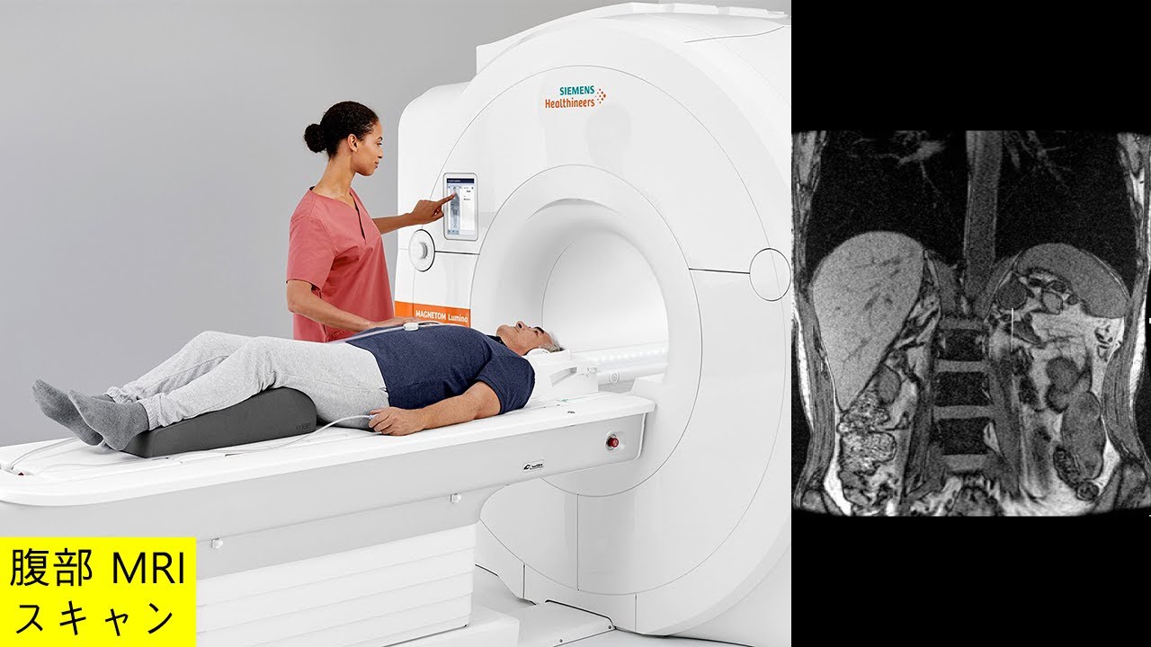 腹部のMRI 第3版 | 荒木 力 |本 | 通販 | Amazon
