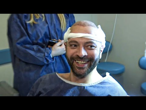 Vidéo: Maria Pogrebnyak a transplanté des cheveux de l'arrière de la tête à ses sourcils
