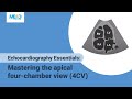 Echocardiography Essentials: Mastering the apical four-chamber view (4CV)