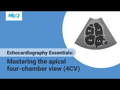 Echocardiography Essentials: Mastering the apical four-chamber view (4CV)