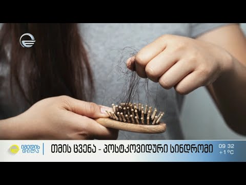 თმის ცვენა - პოსტკოვიდური სინდრომი