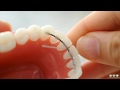 How to floss under your fixed retainer wire | Evolution Orthodontics