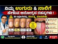 ⚠️ ಈ ಉಗುರು ಮತ್ತು ನಾಲಿಗೆಯ ಲಕ್ಷಣಗಳು ಗಂಭೀರ ಕಾಯಿಲೆಗಳ ಸೂಚನೆಯಾಗಿರಬಹುದು!