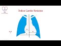 Como medir el índice cardiotorácico (ICT) en la radiografía PA de tórax
