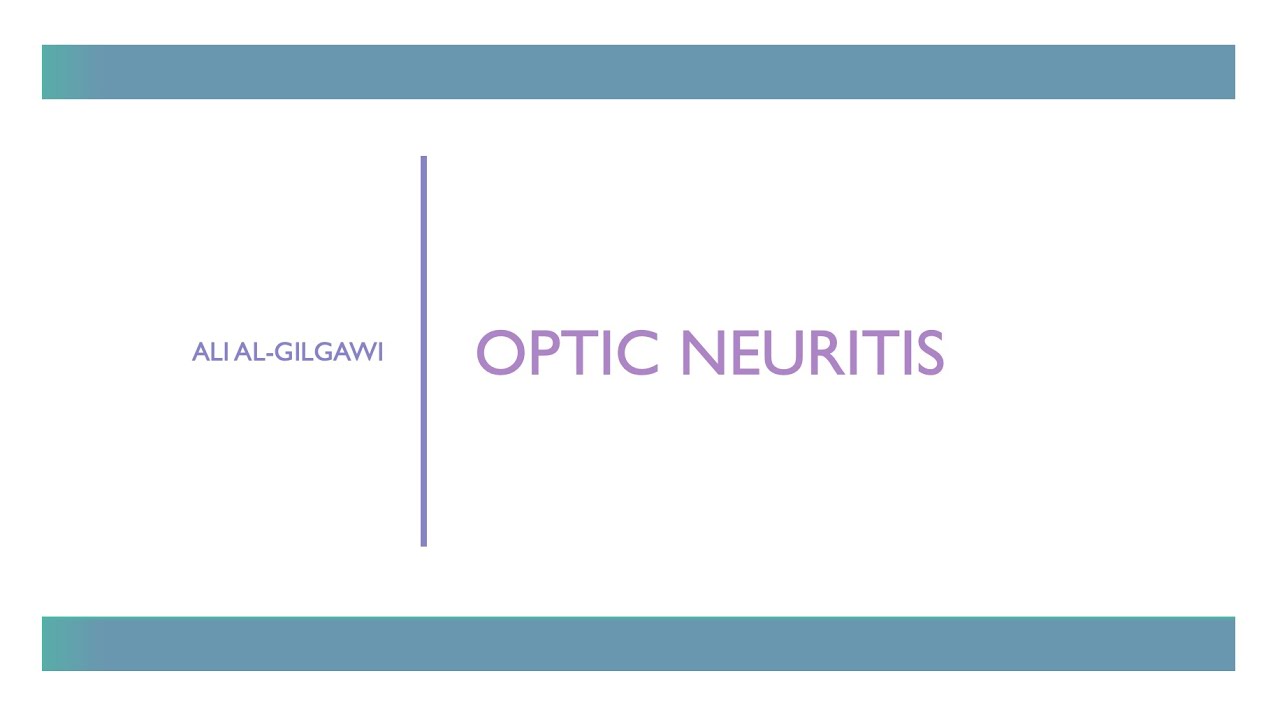 Optic Neuritis: Typical vs Atypical Causes