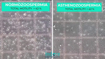 Asthenozoospermia | Sperms with Low Motility | Side by side comparison  Normal Vs Asthenozoospermia