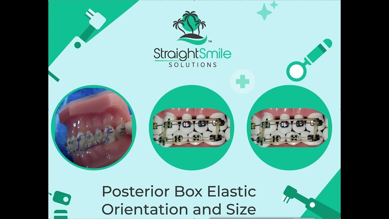 Posterior Box Elastics Size and Strength YouTube